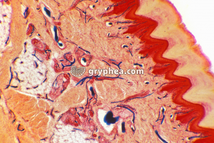 CT Peau injectée x25 - gryphea.org